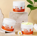 Load image into Gallery viewer, Crème anti acné
